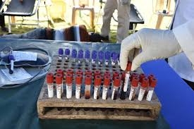 EXPLAINER: Why Syphilis is a threat to health and its stigma