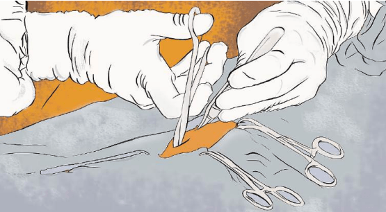 OKUMU: The neglect of surgical access in Kenya