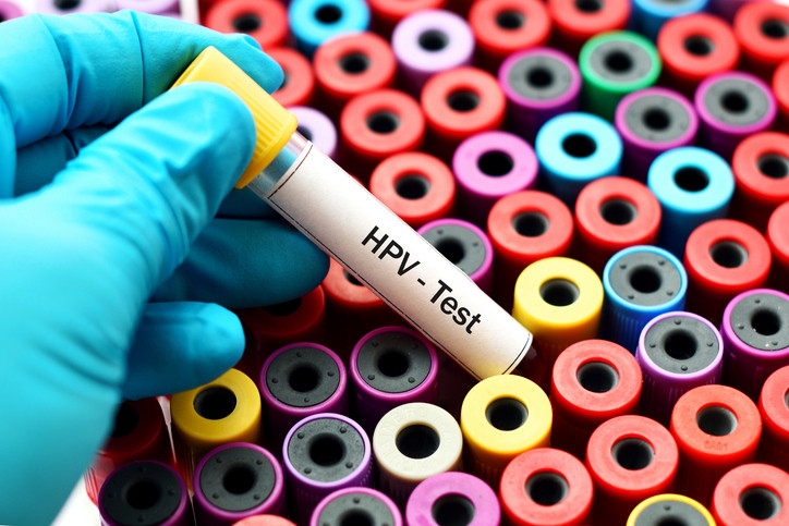 Why early HPV testing is the open weapon against cervical cancer