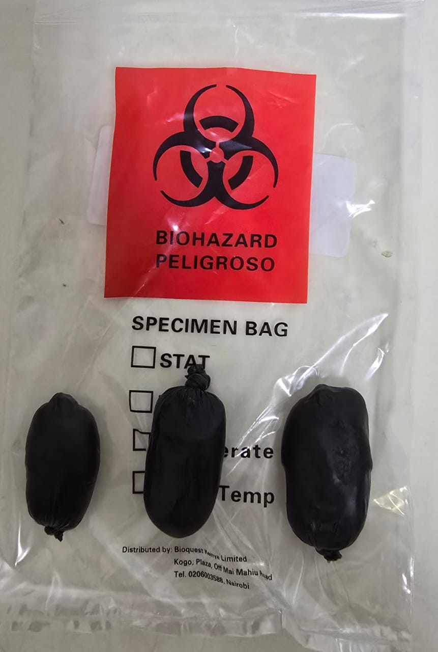 American hospitalised in Nairobi after ingested cocaine bursts