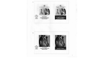 Cigarettes, nicotine pouches to carry new graphic health warnings