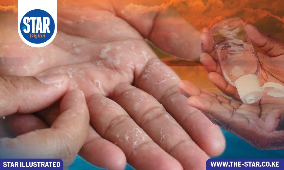 Causes of skin peeling