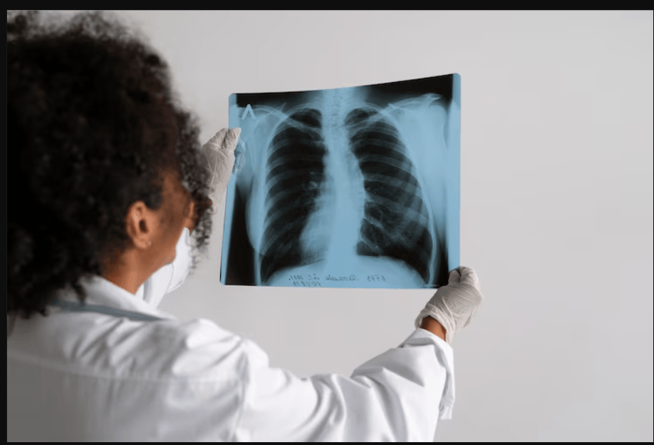 Experts probe strange rise of throat cancer among Kenyan Somalis