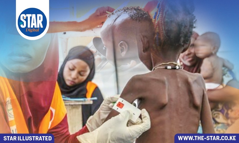 Causes of high malnutrition in arid areas