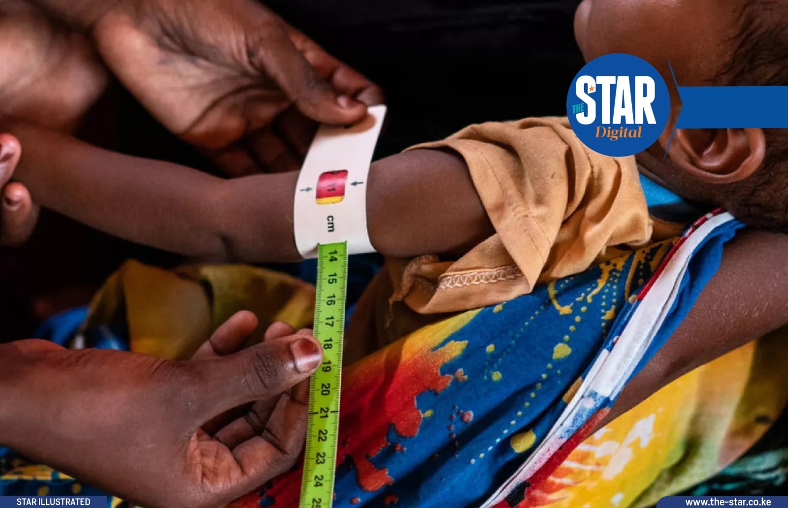 Counties leading in malnutrition
