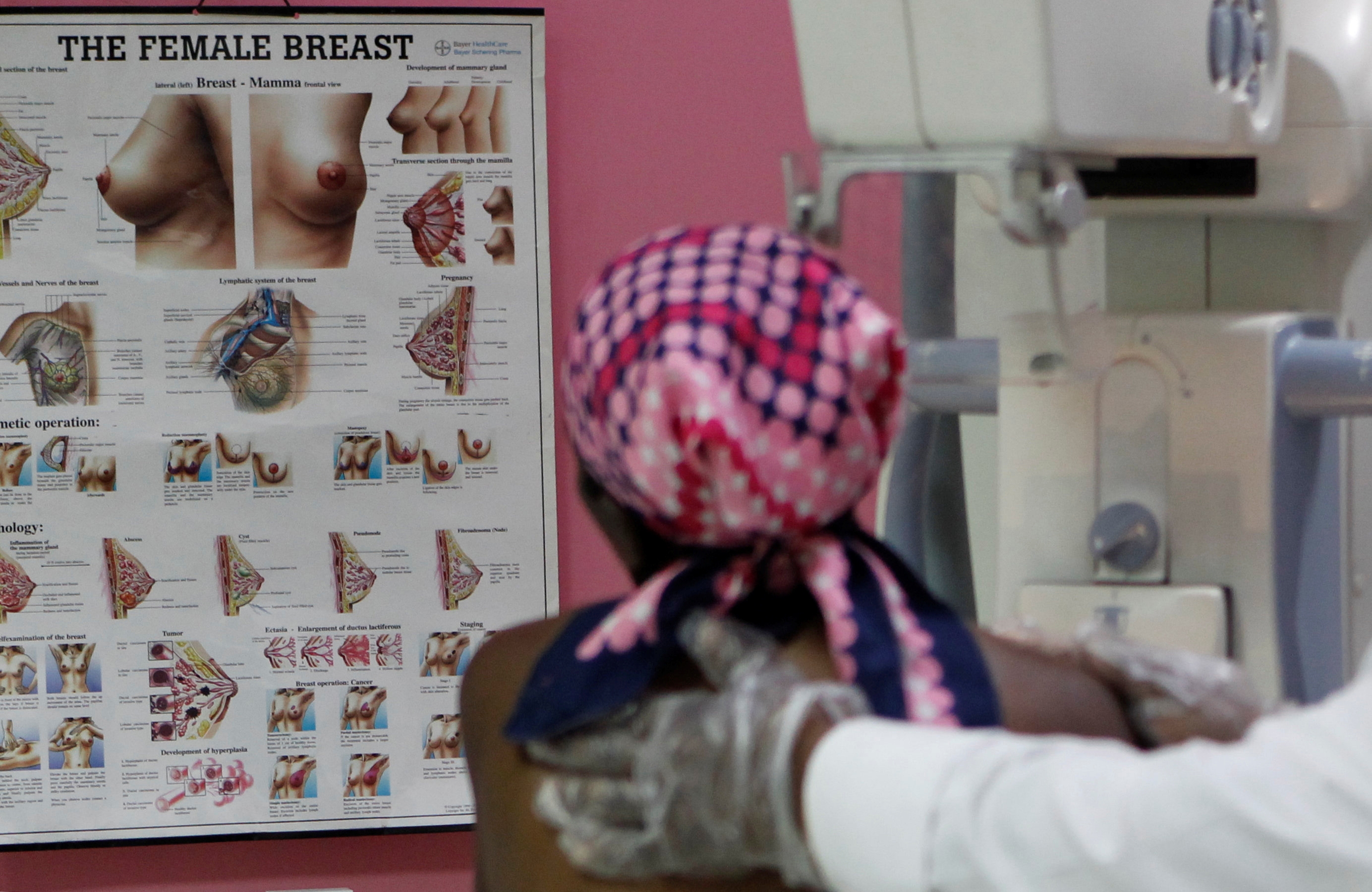 Study identifies two new breast cancer genes in African women