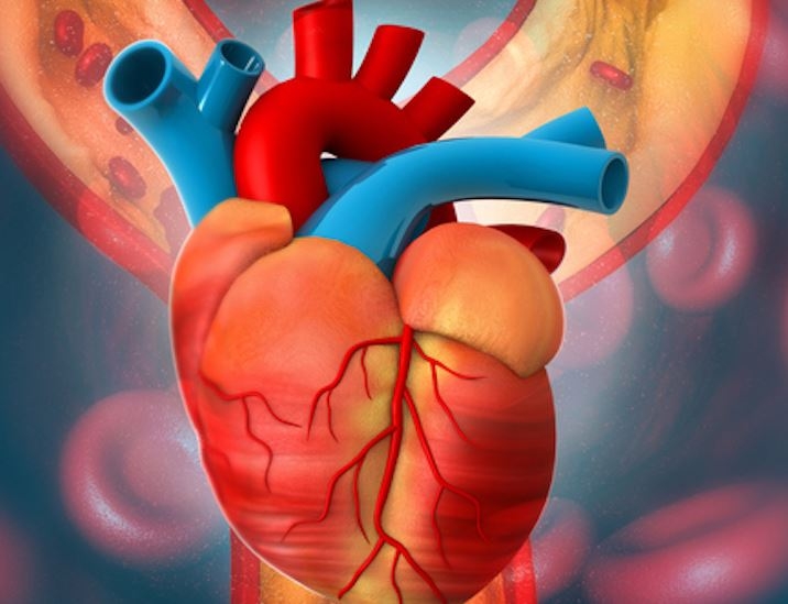 OSANO: Bridging the gap in congenital heart disease detection