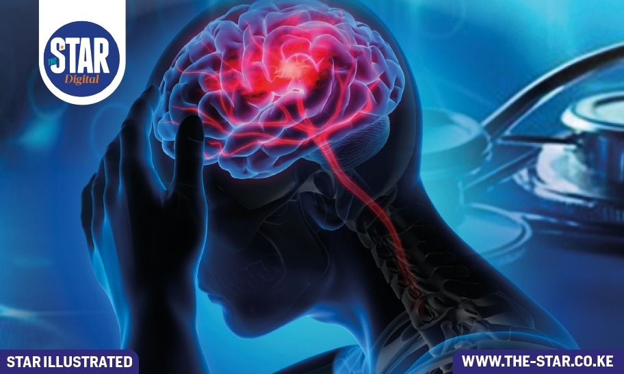 What you need to know about World Alzheimer’s Day