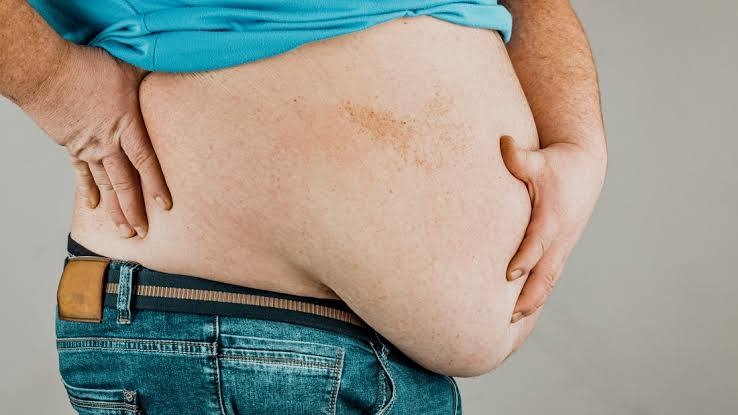 WHO, UN task force honor global champions in obesity fight