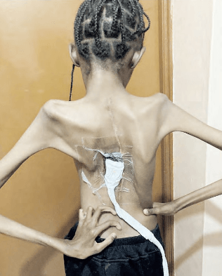 Mother’s plea to save daughter with rare health condition